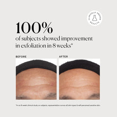 Azelaic Acid Derivative Complex 10% - Jumbo